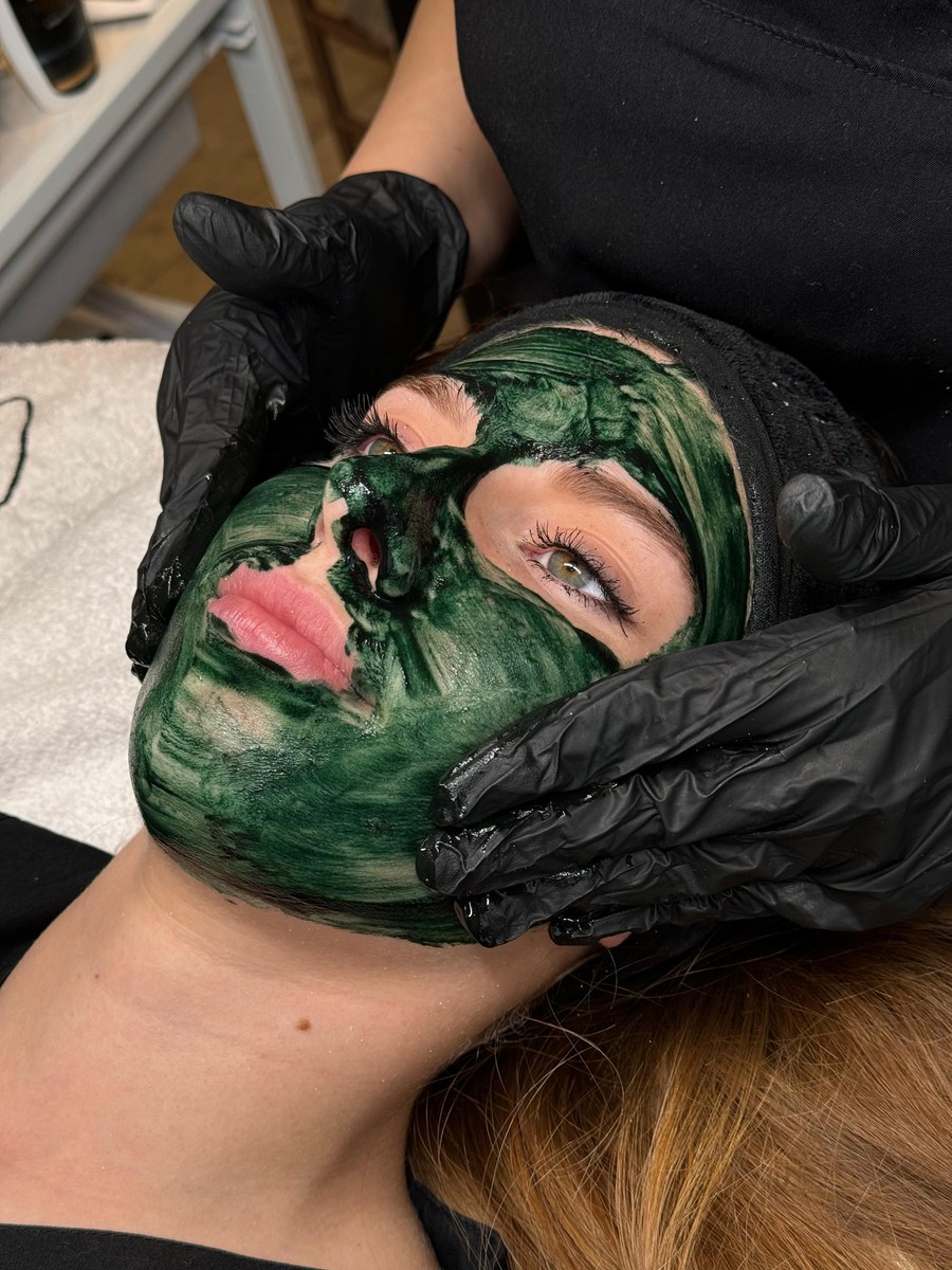 Bio Microneedling bei Beauty by Gashi in Grenchen